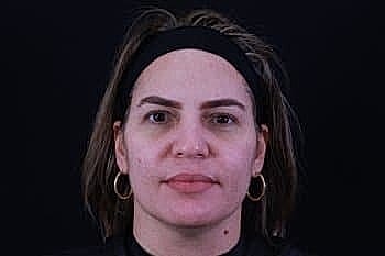 Woman with neutral expression against dark background.