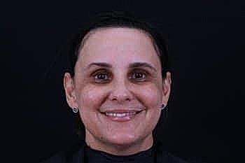 Botox Dysport Before & After